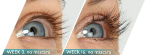 LATISSE_00_victoria_eyes